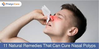 The nose is also the main gate to the respiratory system, your body's system for breathing. 11 Natural Remedies That Can Cure Nasal Polyps Pristyn Care
