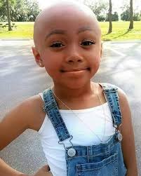 SHE IS CANCER SURVIVOR 💪👏❤️❤️ SHOW SOME LOVE ❤️❤️❤️ This cute baby girl  survived cancer, because of that hair can not grow