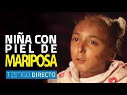 Anencefalia Enfermedad Perturbadora Agaclip Make Your Video Clips