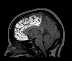 Pin On Brain Functions