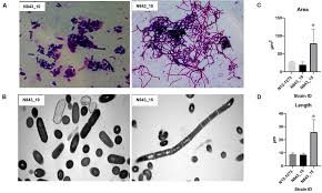 Some listeria bacteria under the microscope (3d render. Frontiers Evolution Of Listeria Monocytogenes During A Persistent Human Prosthetic Hip Joint Infection Microbiology