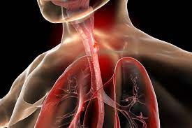 We did not find results for: Kanker Esofagus Patofisiologi Diagnosis Penatalaksanaan Alomedika