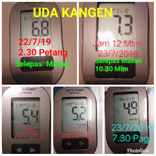 Bagi gula ketika berpuasa bacaan normal adalah di bawah 7mmol/l, dan bacaan ketika tidak berpuasa dikira normal di bawah 11 mmol/l. Bacaan Normal Gula Dalam Darah Selepas Makan