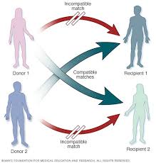 Kidney Transplant Mayo Clinic