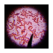 While a majority of bacteria share these characteristics, they vary in shape. What Is Cocci Bacteria Quora