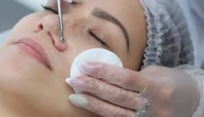 как очистить лицо от черных точек в домашних условиях содой Glubokaya Chistka Lica V Domashnih Usloviyah Tehnika Provedeniya I Effektivnost Zdorovaya Semya