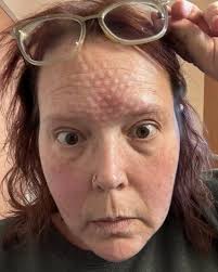 Fundraiser for Steve Sundby by JIMMY MARS : #LivStrong: Support Olivia's  Battle with Stage 4 Cancer