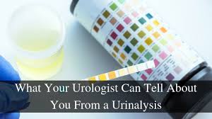 There are two simple tests for kidney disease: What Your Urine Says About You Urology Specialists