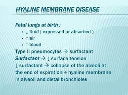 Ppt Hyaline Membrane Disease Powerpoint Presentation Free Download Id 2033103