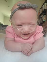 Reintroduction of a spirited 7-year-old girl