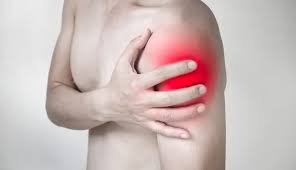 Image result for Muscle Weakness