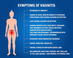 Image result for Vaginitis