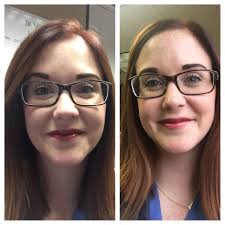 Has anyone else experienced unbearable lip pain after dental implant  surgery?