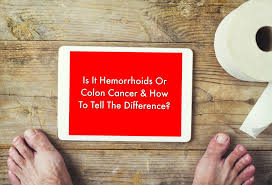 It's one of the most common types of cancer in the uk; Hemorrhoids Or Colon Cancer How To Tell The Difference