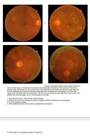 I know my limit colossal wine glass 16 reviews $29.99 Solved A 40 Year Old Female Presents With Sudden Blurring Chegg Com