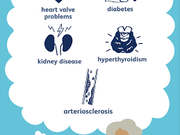 We discuss natural ways to reduce blood one reason for this may be genetic differences in how people process sodium. Understanding Isolated Systolic Hypertension