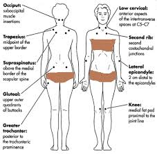 Pin On Referred Pain