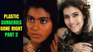 Top 9 Bollywood Actress Plastic Surgeries Gone Right Part 2 Plastic Surgery Bollywood Actress Liposuction Top 10 bollywood actresses who looks horrible after plastic surgery | you won't believe 1.