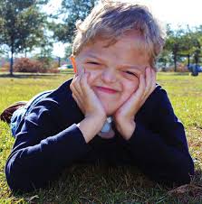 thankful for crouzon syndrome