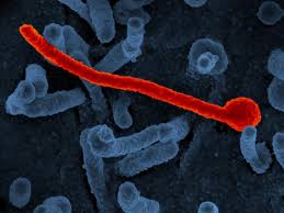 Learn about signs to look for, as well as causes, risk factors, and treatment. Despite Mutations In Makona Ebola Virus Disease Consistent In Mice Monkeys National Institutes Of Health Nih