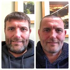 The Consort Services Directors Tony Barry and Paul Crew have shaved their  heads, along with 15 of their friends and raised thousands to help NHS  fight against coronavirus. 👏🏻👏🏻👏🏻 Click