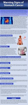 Some common cancer signs that should result in a visit to the emergency room or to a doctor as soon as possible include: Digestive Cancers
