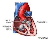 Image result for what is the treatment for mitral valve regurgitation