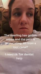 Dealing with Pain After Root Canal Treatment