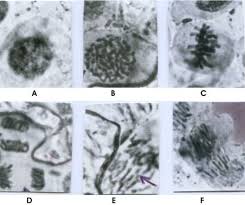 We did not find results for: Photomicrograph Of Some Normal Stages And Aberrations In Mitotic Download Scientific Diagram