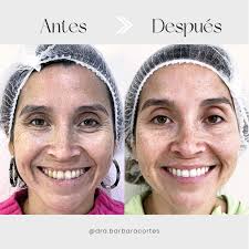 Dra. Bárbara Cortés (@dra.barbaracortes) • Instagram photos and videos