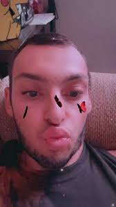 Victor Schade Hd Carlton