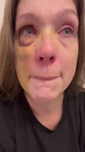 news The woman who was knocked unconscious by a male when a mob attacked  her and another man in Cincinnati- is speaking out. #Ohio Holly expressing  her gratitude through a tearful message, "