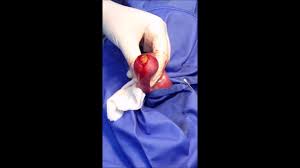 With our tucson veterinarians being animal lovers themselves, we know the importance of your pet to you. Canine Enterotomy At First Pet Veterinary Clinic Amman Jordan Youtube