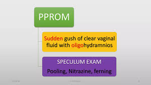 Image result for Vaginal Pooling