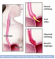 Image result for esophagus