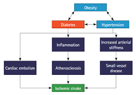 Image result for Stroke Pathophysiology