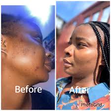 Hmmm…have you decided? 😊