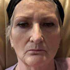 THE BEST 10 LASER HAIR REMOVAL near ELIZABETHTOWN, KY 42701