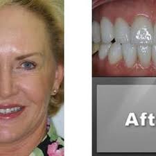 DUANE HEDRICK, D.D.S.