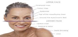 Christa billich was one of the first people to use botox when it arrived here 15 years ago. How Long Does Fillers And Botox Effect Last