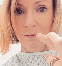 Why is lung cancer killing more women than ever?