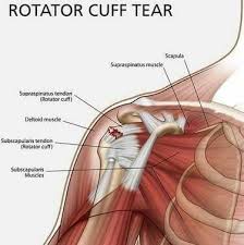 Muscles Anatomy Physiology Health Fitness Training Muscle Bone Shoulder Rotator Cuff Tear Rotator Cuff Tear Treatment Rotator Cuff Injury