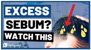 One looming question regarding the reason for hair loss is that can excess sebum cause hair loss? How To Remove Excess Sebum In The Scalp For Hair Loss Youtube