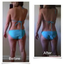 Your story will inspire others to help them lose weight and live a healthier lifestyle! Laxatives For Weight Loss Before And After Weightlosslook