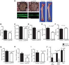 Therefore, in vivo bone labeling has become a. Chronic Skin Inflammation Leads To Bone Loss By Il 17 Mediated Inhibition Of Wnt Signaling In Osteoblasts Science Translational Medicine