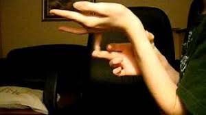 Może wystąpić pęknięcie tętnicy lub narządu, co może doprowadzić do nagłej śmierci. Ehlers Danlos Syndrome Zespol Ehlersa Danlosa Eds Morbid Morbid Pinger Pl