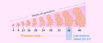 Image result for Preterm Infant