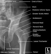 510 x 441 jpeg 64 кб. Hip Radiographic Anatomy Wikiradiography Radiology Student Anatomy Radiology Technologist