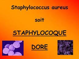 Epingle Sur Etude