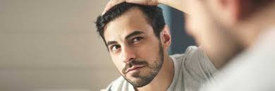 Circa un terzo della popolazione mondiale, infatti, pare essere affetta da calvizie in modo più o meno grave già tra i 12 e i 20 anni. La Caduta Dei Capelli Cause Tipologie Sintomi Rimedi